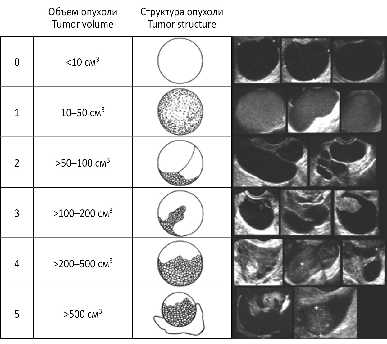 O rads. Классификация iota опухолей яичников. O-rads классификация образований яичников. O-rads УЗИ. Морфологический индекс.