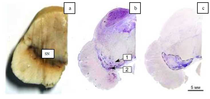 substantia nigra mouse