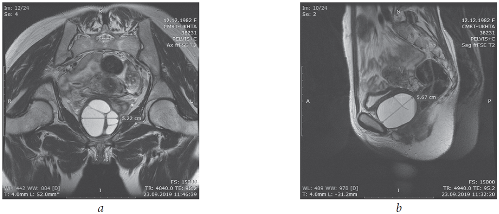 female periurethral glands